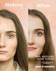 Purifying Toner